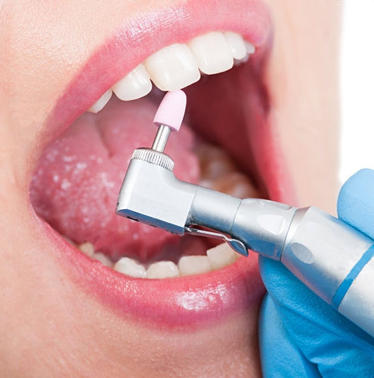 Dentálna hygiena a prevencia